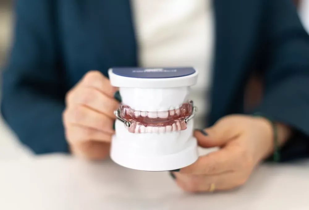 Custom oral appliance on a dental model at Green Dentistry in Alexandria, VA