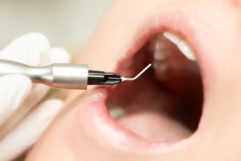 Ozone-assisted treatment reducing bacteria during care at Green Dentistry: Root and Restore in Alexandria, VA
